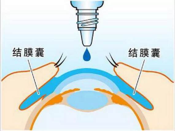 微信图片_20210309141746_缩小大小.jpg